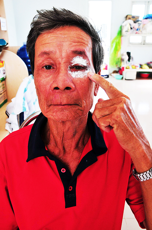 Mắt trái ông Phạm Văn Đấu  bị ngứa, rát vùng da