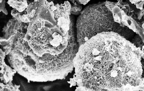 Hình ảnh các hạt carbon xốp chụp bằng kính hiển vi điện tử