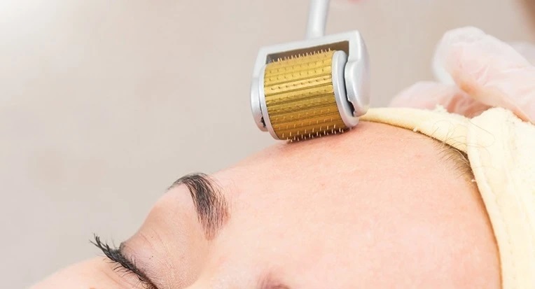 Những sai lầm khi lựa chọn lăn kim làm đẹp