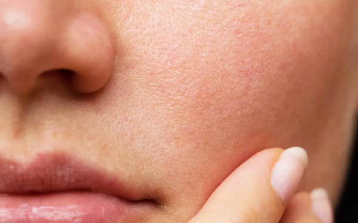 Những dấu hiệu trên da cho thấy cơ thể đang căng thẳng