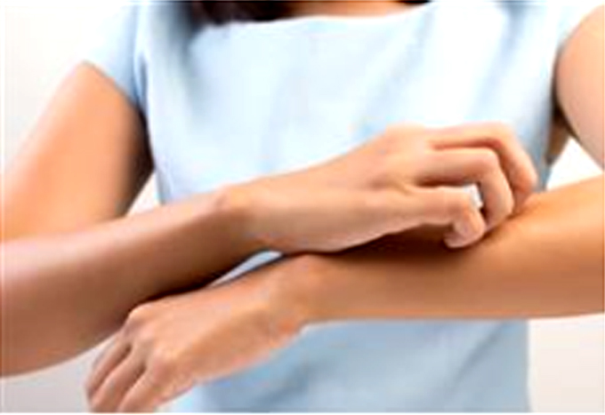 Phát hiện lợi ích bất ngờ của việc gãi ngứa