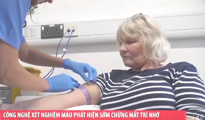 Công nghệ xét nghiệm máu giúp phát hiện sớm chứng mất trí nhớ