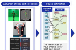 Nhật Bản: Ứng dụng AI chẩn đoán và gợi ý bài tập trị đau lưng mãn tính