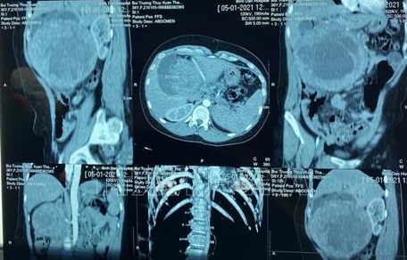 Ảnh minh họa: Đinh Hằng/TTXVN