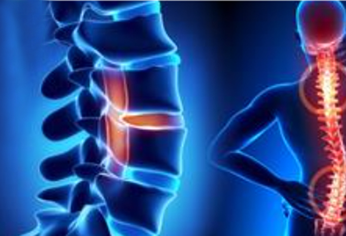 Điều trị chấn thương tủy sống bằng tế bào gốc