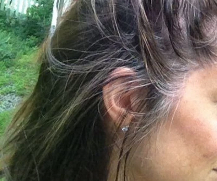 Vị trí tóc bạc phản ánh tình trạng sức khỏe của bạn như thế nào?