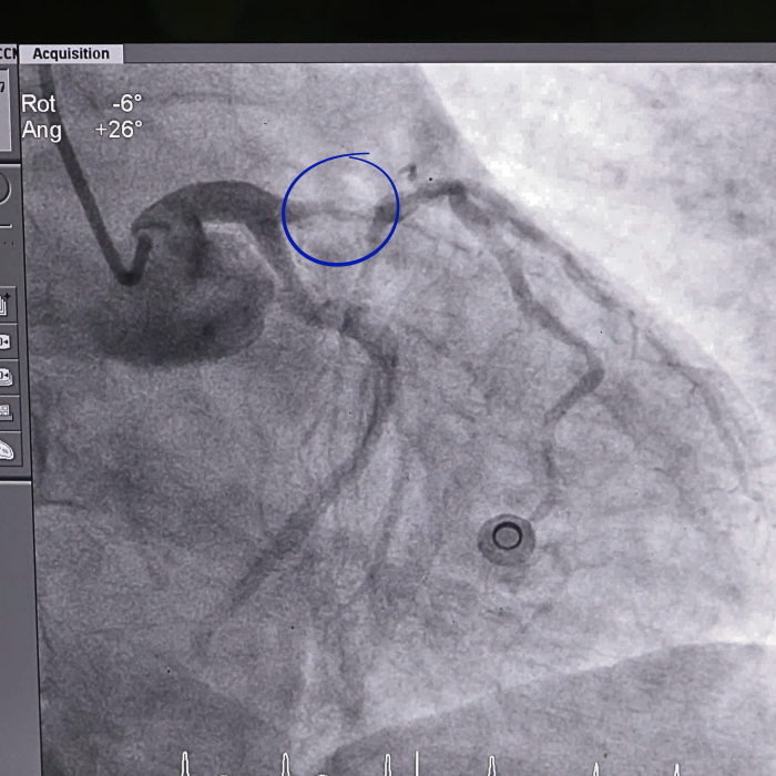 Bệnh viện Đa khoa Ninh Thuận cứu sống bệnh nhân 3 lần ngưng tim