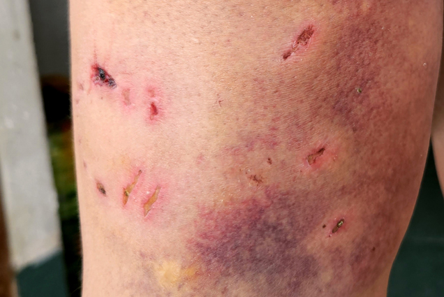 Cẩn trọng với bệnh dại chó mèo