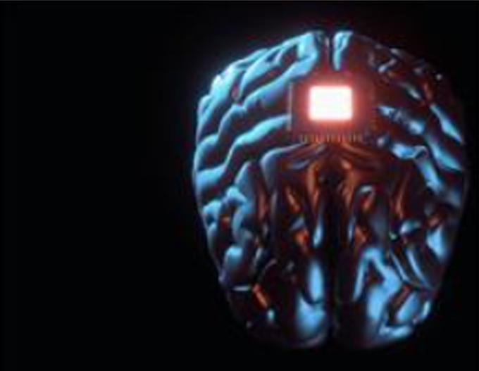 Cấy ghép não giúp biến suy nghĩ thành giọng nói