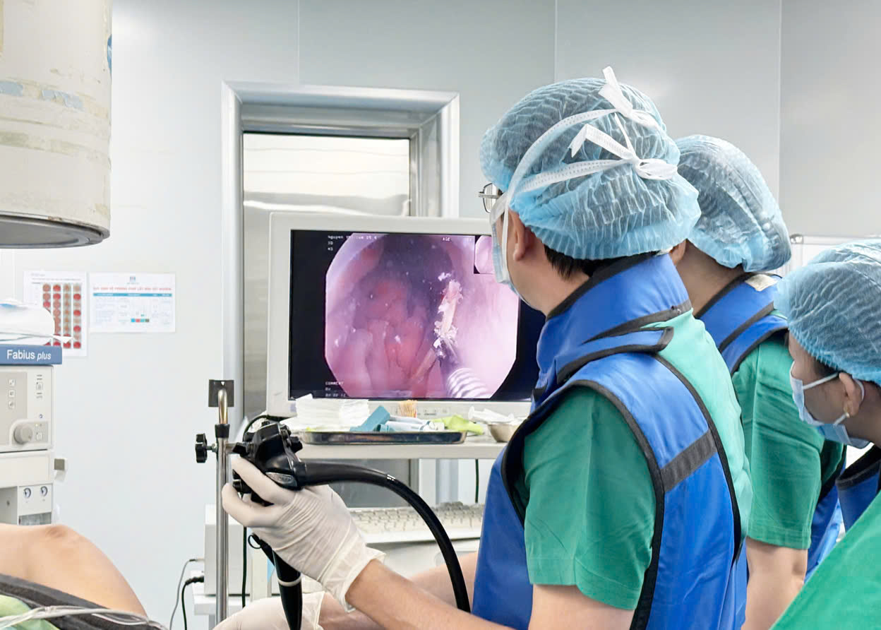 Bệnh viện 22-12 thực hiện nội soi can thiệp lấy đoạn xương cá đâm xuyên thành dạ dày cho bệnh nhân