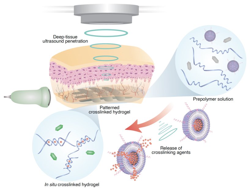 Công nghệ in 3D trong cơ thể bằng sóng siêu âm (Ảnh: Science)