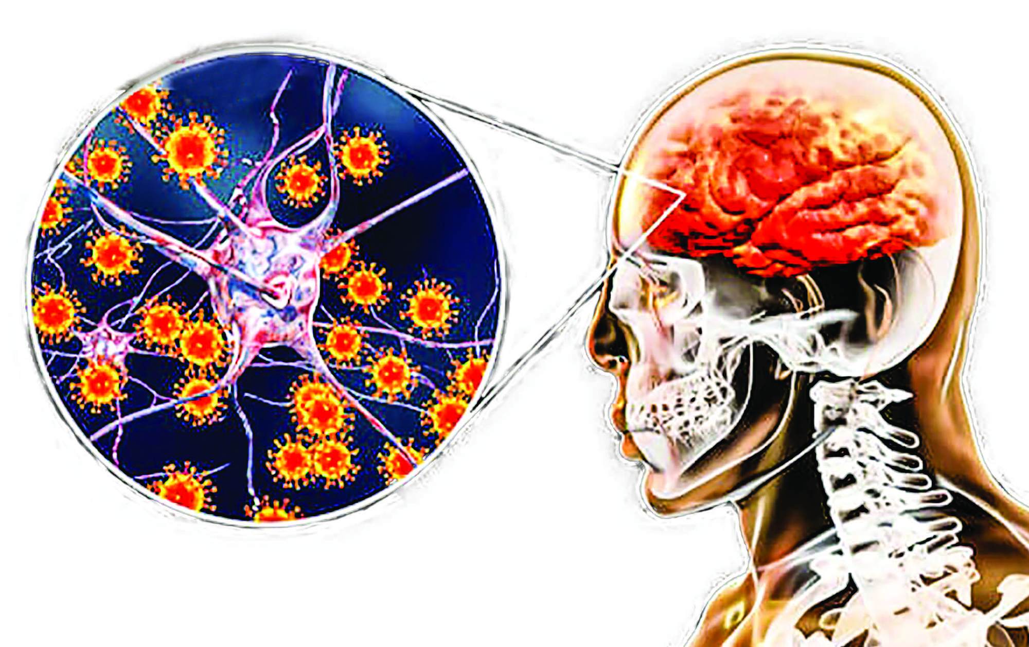 Cảnh giác với bệnh viêm não Nhật Bản khi vào hè