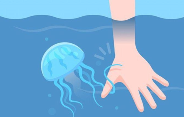 Cách cấp cứu khi đi biển bị sứa "cắn"