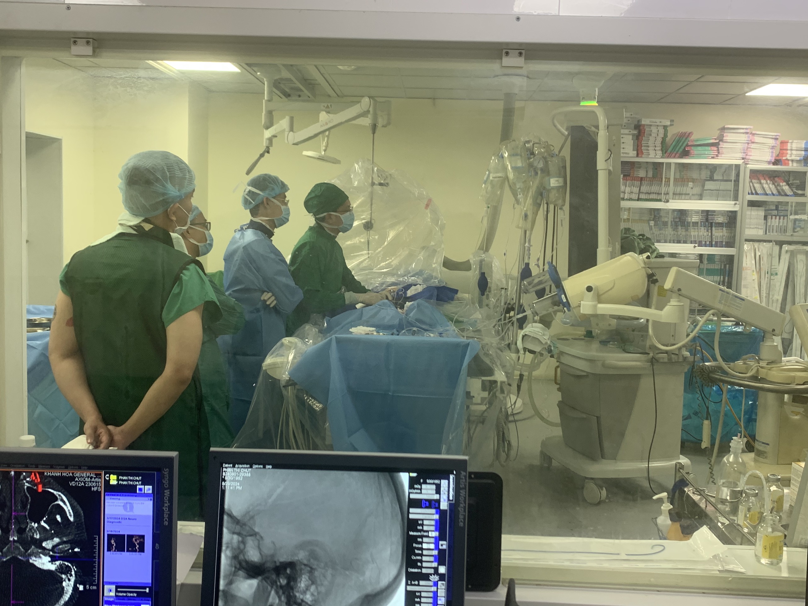 Điều trị thành công rò động tĩnh mạch màng cứng gây xuất huyết não