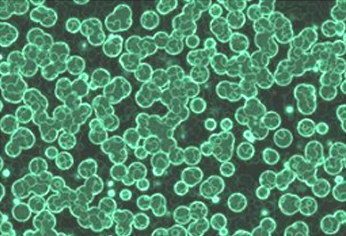 Nga phát triển công nghệ chiết xuất chất béo từ vi sinh vật