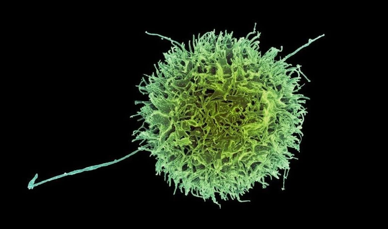 Đại học Monash phát hiện cơ chế tăng sức mạnh cho tế bào diệt ung thư