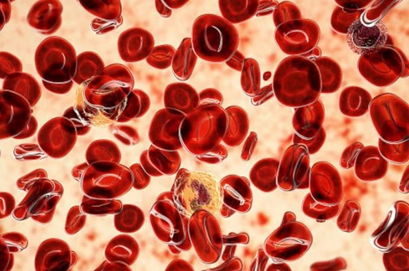 Xét nghiệm đột phá giúp phát hiện nguy cơ mắc bệnh bạch cầu