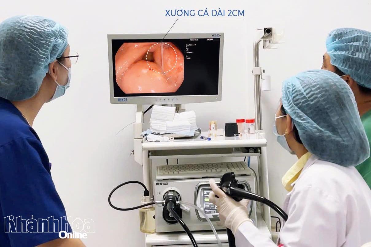 Ê-kíp bác sĩ Bệnh viện 22-12 nội soi gắp dị vật cho bệnh nhân.
