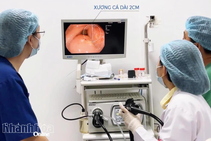 Bệnh viện 22-12 kịp thời gắp dị vật xương cá cắm vào dạ dày bệnh nhân