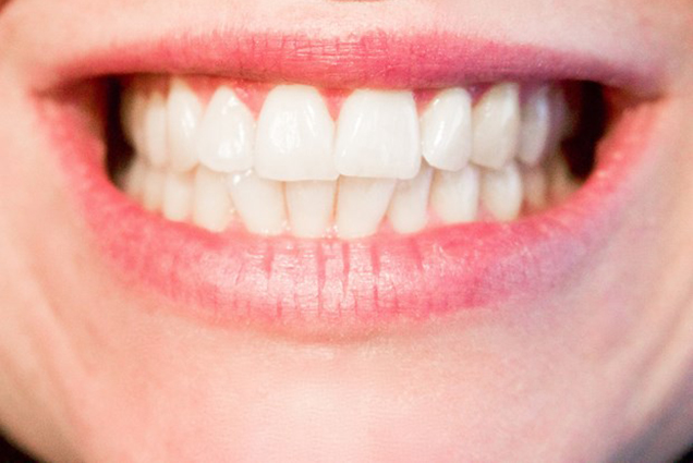 Nghiên cứu thuốc có khả năng kích thích răng mọc trở lại