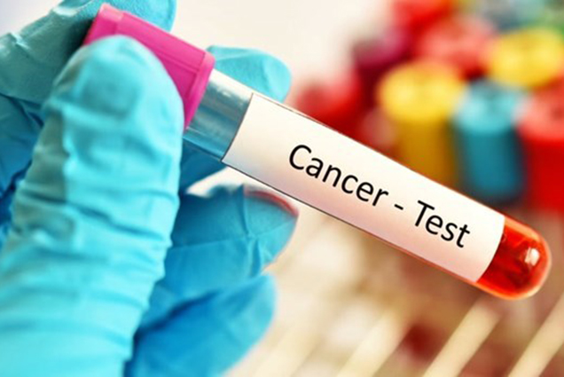 Australia đạt được bước đột phá trong việc sàng lọc ung thư ruột