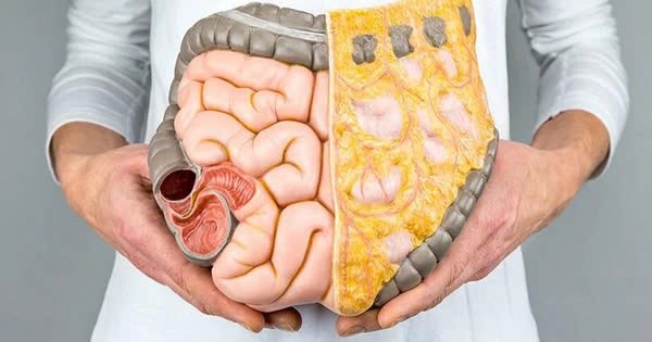 Cách "đào thải" mỡ nội tạng ở người trung niên