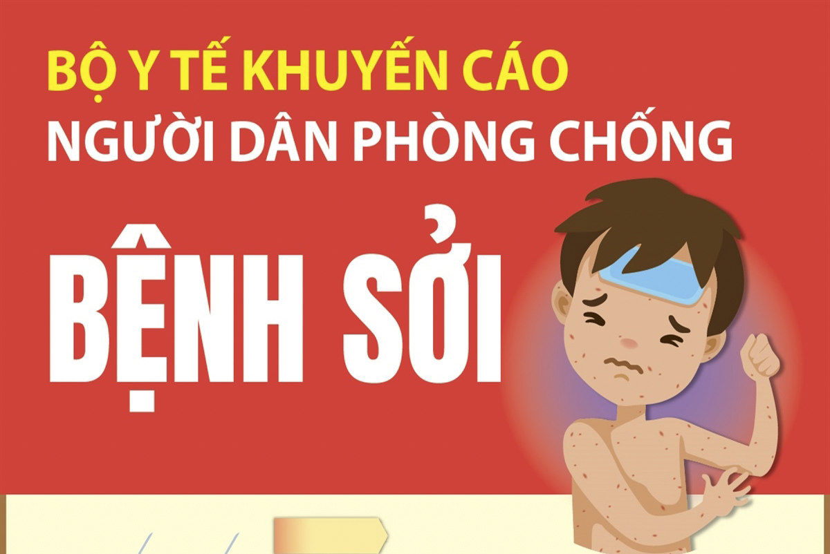 Bộ Y tế khuyến cáo người dân phòng bệnh sởi