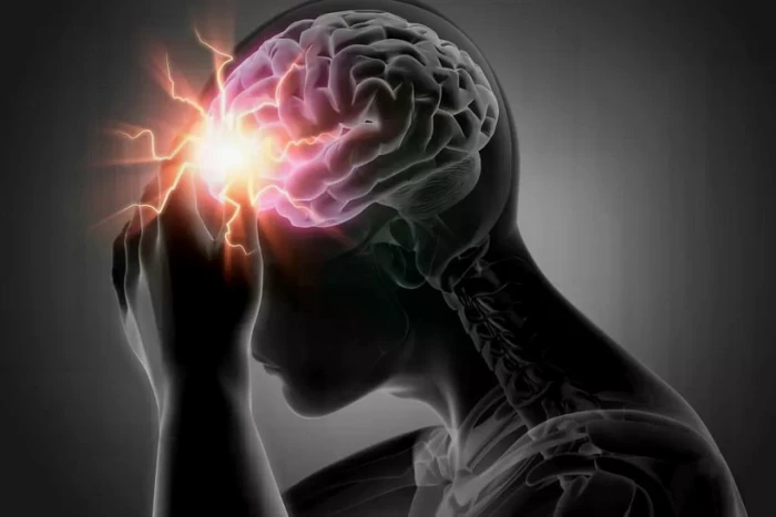 Hiểu đúng về đột tử và đột quỵ để tránh hậu quả nghiêm trọng