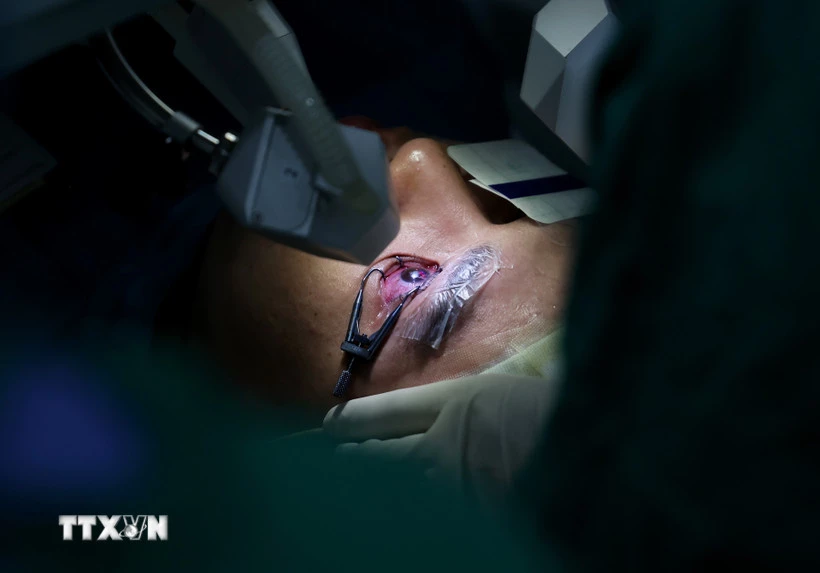 Phẫu thuật mắt bằng tia laser cho bệnh nhân. (Ảnh: Hồng Đạt/TTXVN)