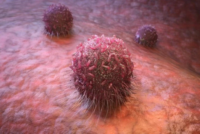 Tia plasma lạnh có thể tiêu diệt tế bào ung thư ẩn sâu