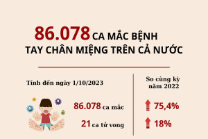 86.078 ca mắc bệnh tay chân miệng trên cả nước