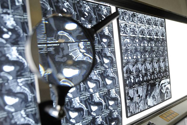 Nga phát triển thuốc điều trị ung thư mới có thể đạt hiệu quả hơn 90%