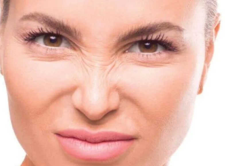 8 cách để làm mờ nếp nhăn sống mũi