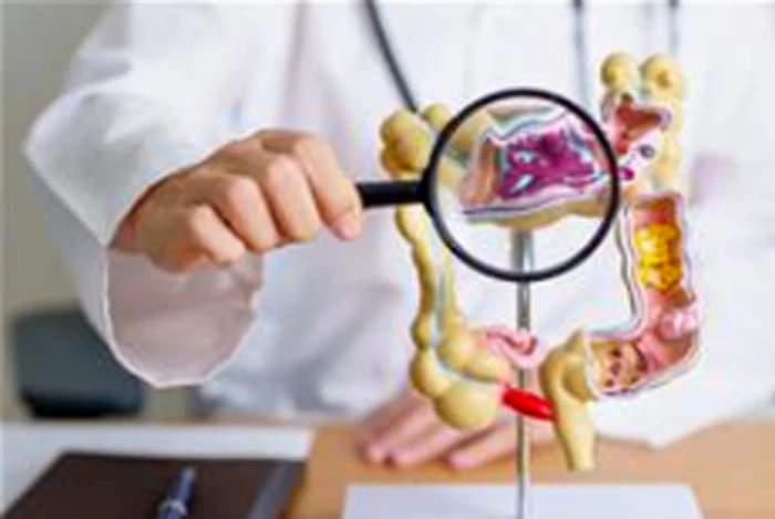 Phát triển máy in sinh học siêu nhỏ có thể chữa lành loét dạ dày