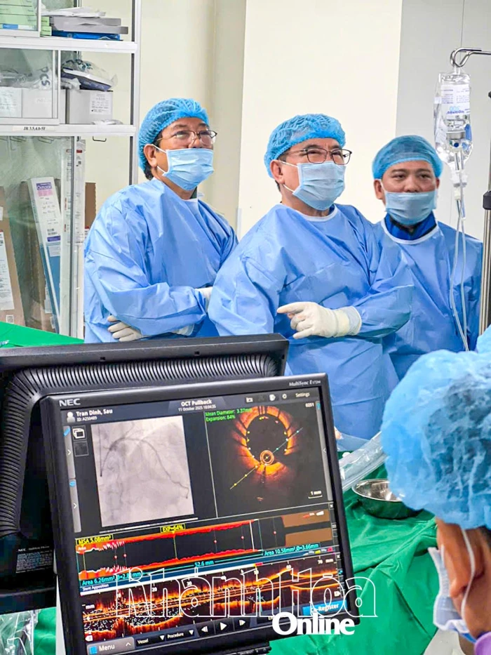 Ứng dụng OCT chẩn đoán, điều trị bệnh tim mạch