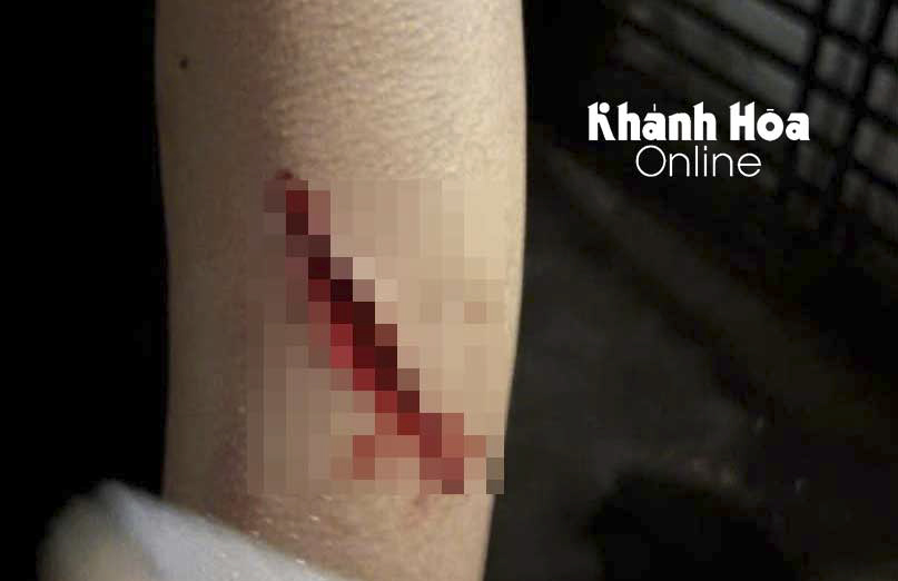 Truy lùng toán cướp gây án lúc rạng sáng