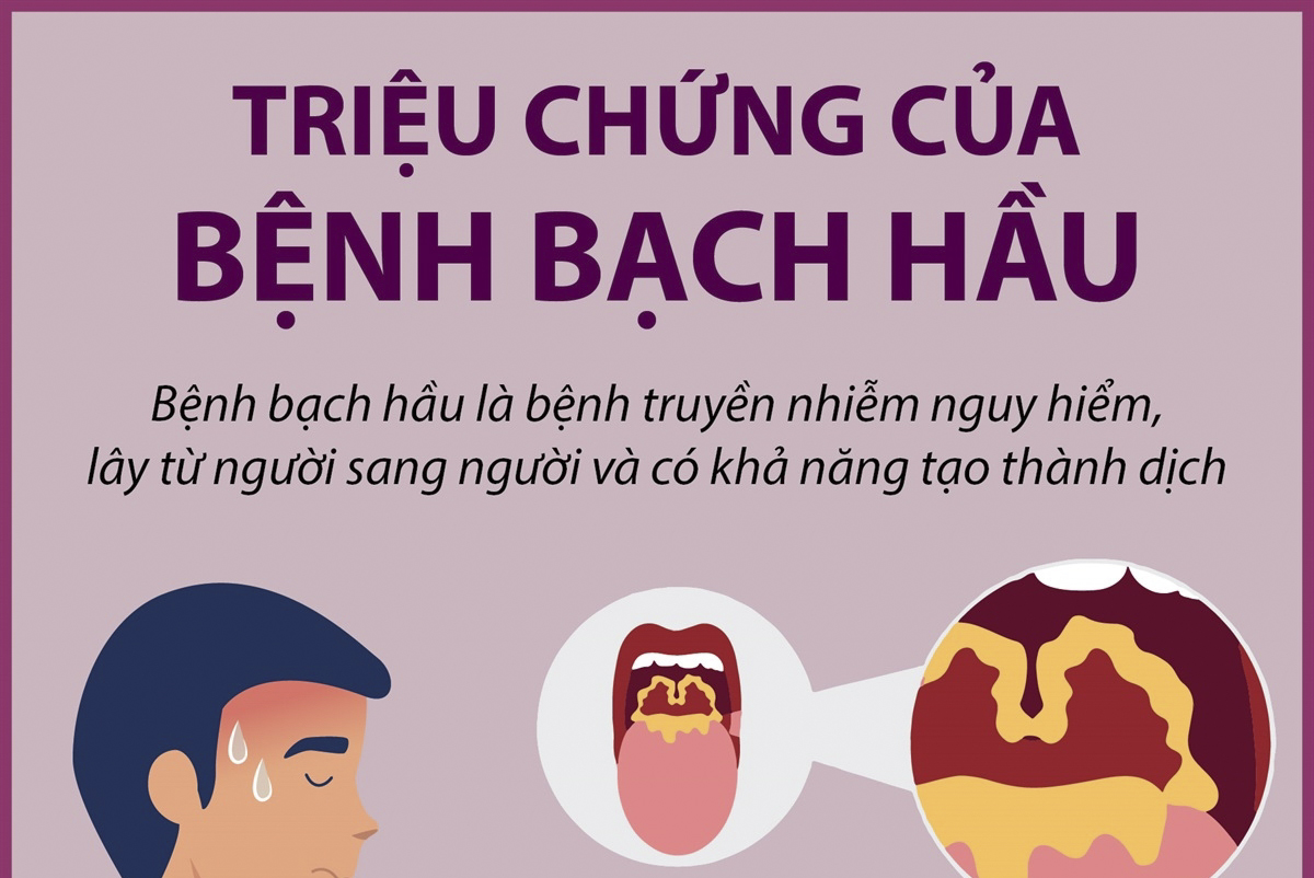 Triệu chứng của bệnh bạch hầu