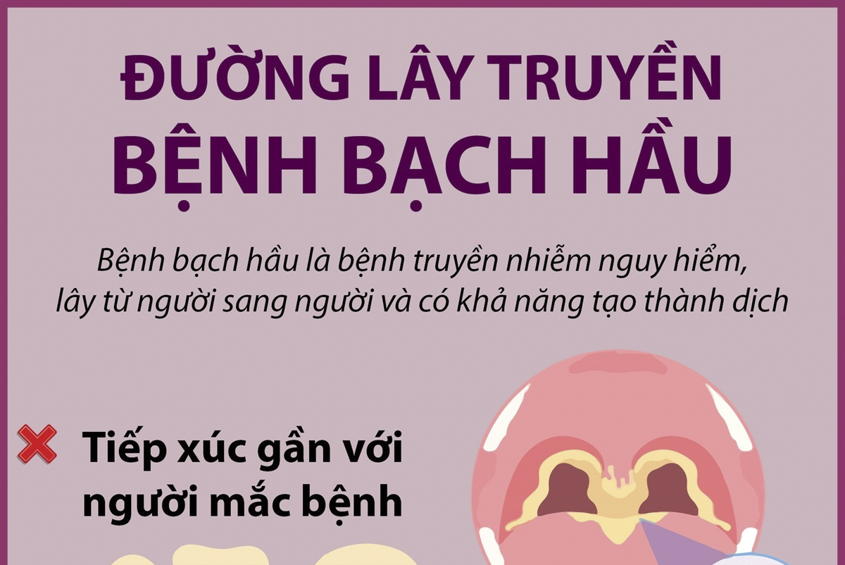 Đường lây truyền bệnh bạch hầu