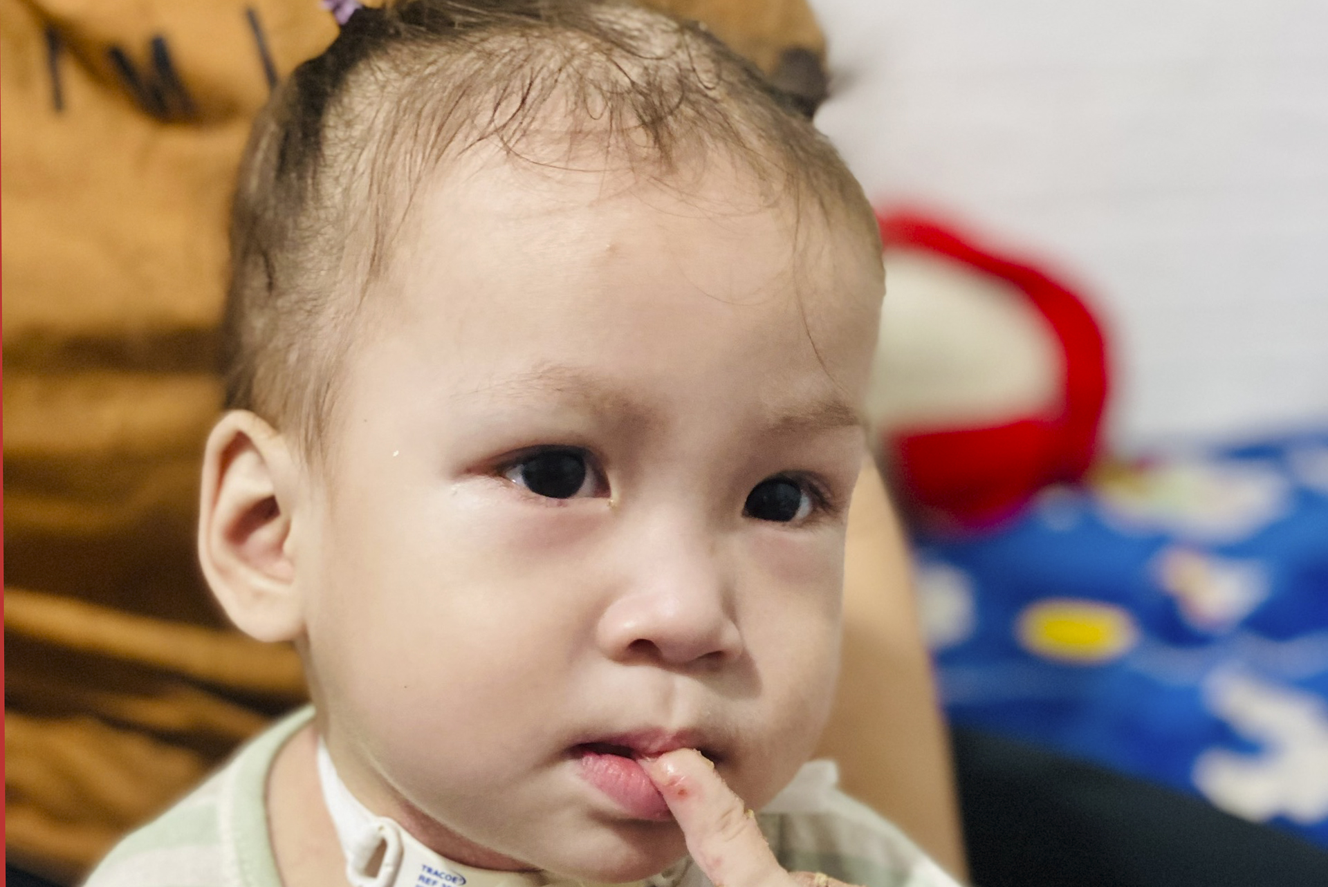 Xót thương cháu bé 18 tháng tuổi mắc nhiều bệnh hiểm nghèo