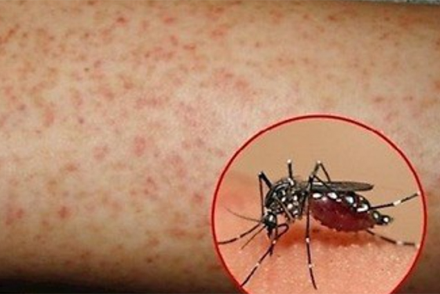 Phòng, chống sốt xuất huyết trong trường học