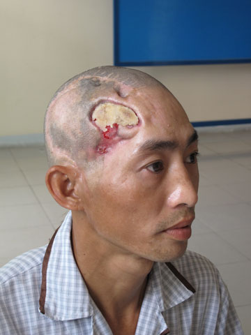 Anh Đỗ Thành Tiến rất cần sự giúp đỡ