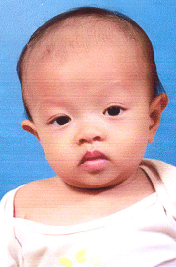 Hãy giúp cháu Ngô Thị Ngọc Trâm sớm được phẫu thuật tim