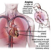 Chất mới chẩn đoán chính xác bệnh suy tim