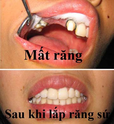 Đến nha sĩ “cải thiện nụ cười”