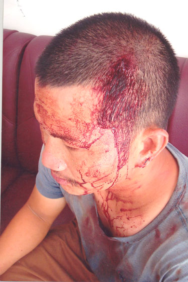 Cần xử lý nghiêm khắc hành vi coi thường luật pháp