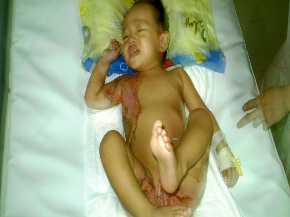 Cháu Thảo Dưng rất cần được giúp đỡ