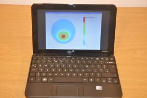 Máy quét di động dựa trên công nghệ tần số vô tuyến có thể hiện thị sự hiện diện khối u vú lành tính (màu đỏ) hay ác tính trên máy tính.