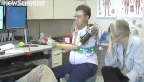 Điều khiển tay giả bằng ý nghĩ