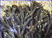 Chữa bệnh viêm đại tràng mãn tính với rau câu