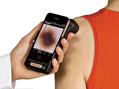 Trong tương lai có thể dùng smartphone để chẩn đoán ung thư - Ảnh: Solent